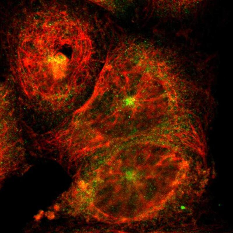 DLG7/HURP Antibody - BSA Free Immunocytochemistry/ Immunofluorescence: DLG7/HURP Antibody [NBP1-87976]