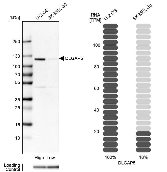DLG7/HURP Antibody - BSA Free Western Blot: DLG7/HURP Antibody - BSA Free [NBP1-87976]