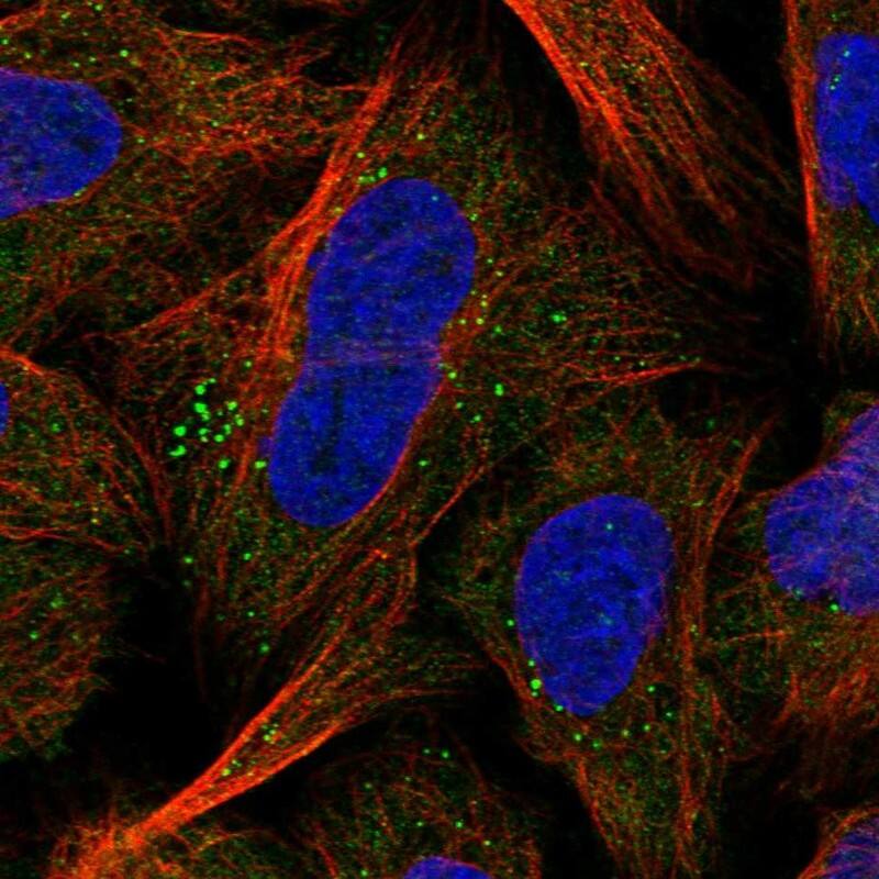GPBP Antibody - BSA Free Immunocytochemistry/ Immunofluorescence: GPBP Antibody - BSA Free [NBP1-87980]