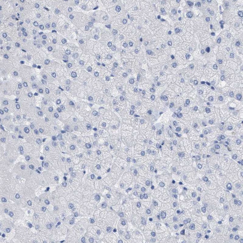 Transgelin/TAGLN/SM22 alpha Antibody - BSA Free Immunohistochemistry-Paraffin: Transgelin/TAGLN/SM22 alpha Antibody - BSA Free [NBP1-87981]