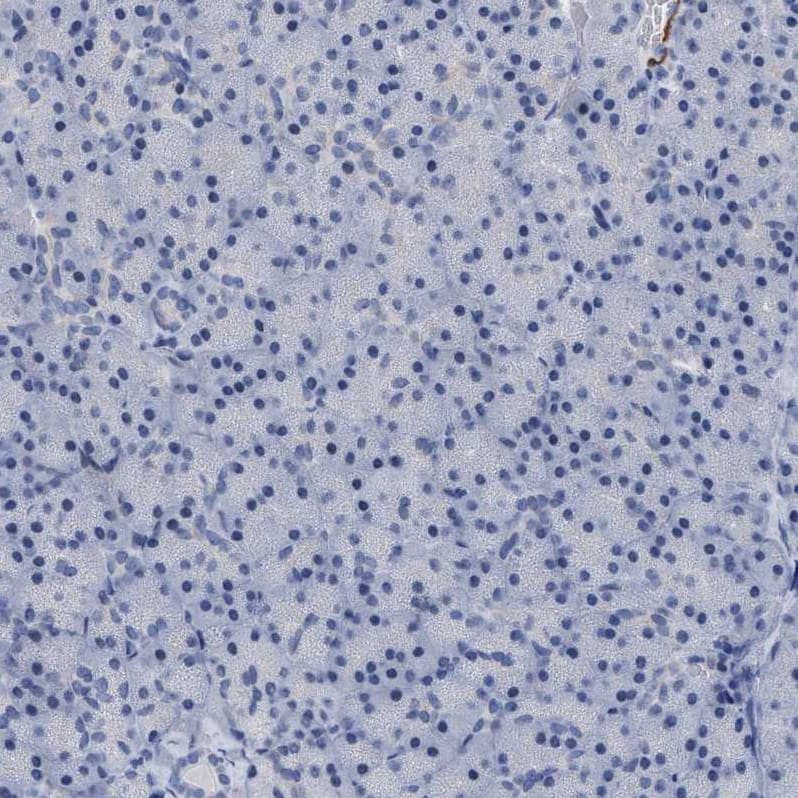 Transgelin/TAGLN/SM22 alpha Antibody - BSA Free Immunohistochemistry-Paraffin: Transgelin/TAGLN/SM22 alpha Antibody - BSA Free [NBP1-87981]