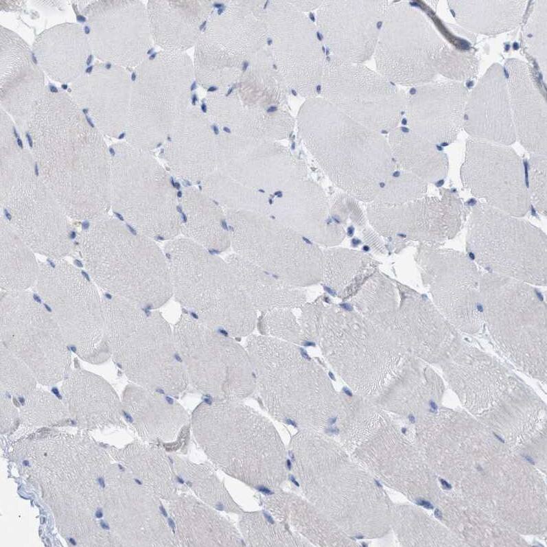 Transgelin/TAGLN/SM22 alpha Antibody - BSA Free Immunohistochemistry-Paraffin: Transgelin/TAGLN/SM22 alpha Antibody - BSA Free [NBP1-87981]