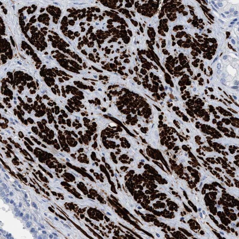 Transgelin/TAGLN/SM22 alpha Antibody - BSA Free Immunohistochemistry-Paraffin: Transgelin/TAGLN/SM22 alpha Antibody - BSA Free [NBP1-87981]