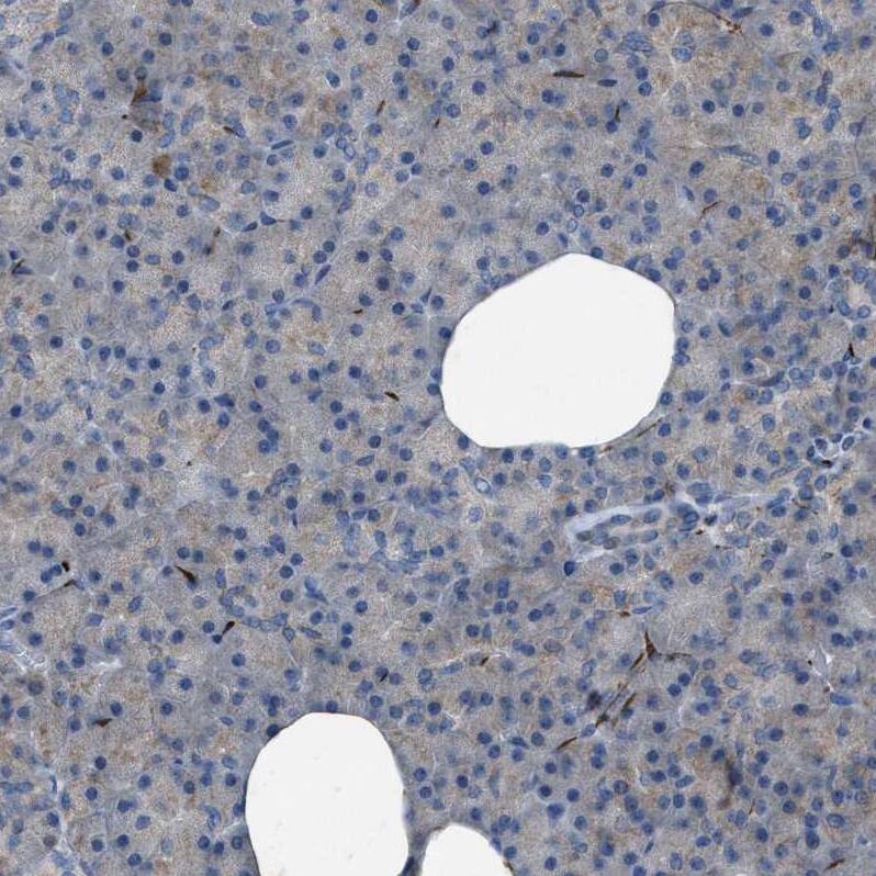 URG4 Antibody - BSA Free Immunohistochemistry-Paraffin: URG4 Antibody - BSA Free [NBP1-87985]