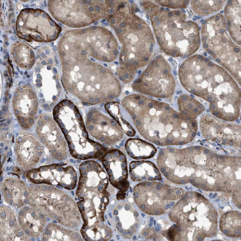 URG4 Antibody - BSA Free Immunohistochemistry-Paraffin: URG4 Antibody - BSA Free [NBP1-87985]
