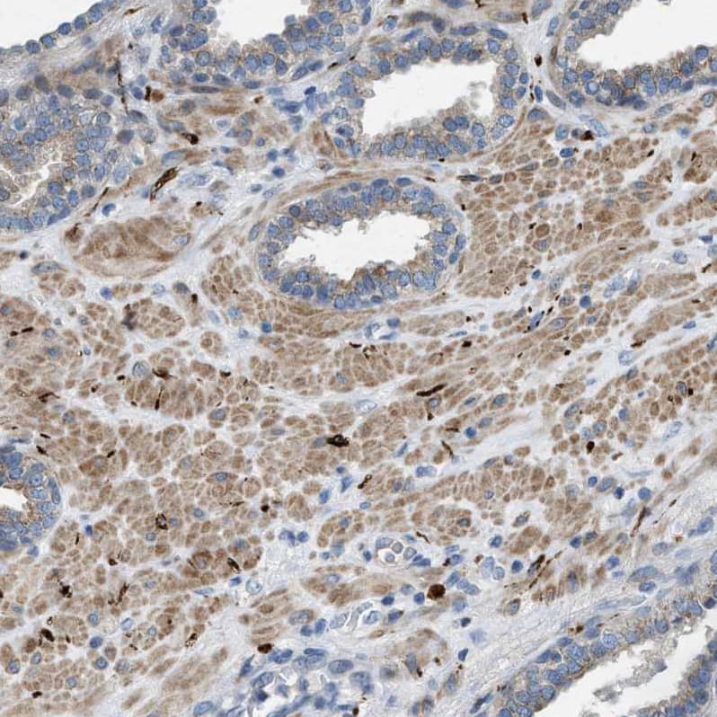 URG4 Antibody - BSA Free Immunohistochemistry-Paraffin: URG4 Antibody - BSA Free [NBP1-87985]