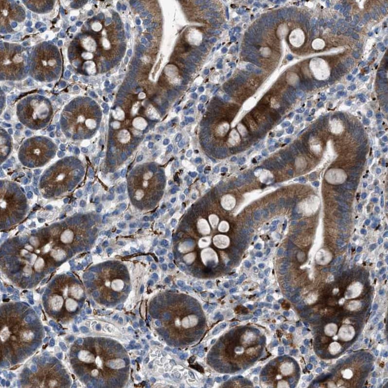 URG4 Antibody - BSA Free Immunohistochemistry-Paraffin: URG4 Antibody - BSA Free [NBP1-87985]