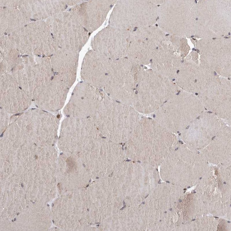 MYD118 Antibody - BSA Free Immunohistochemistry-Paraffin: MYD118 Antibody [NBP1-87990]