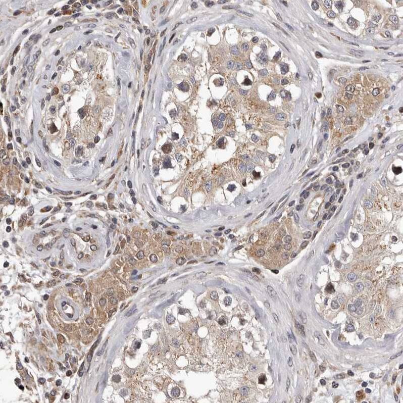 MYD118 Antibody - BSA Free Immunohistochemistry-Paraffin: MYD118 Antibody [NBP1-87990]