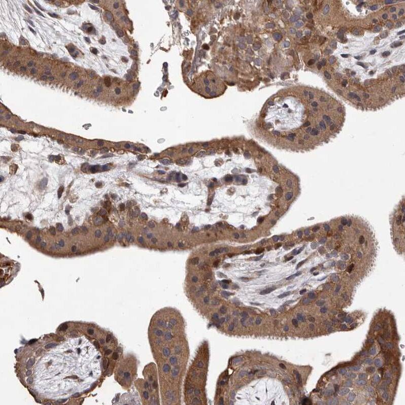 MYD118 Antibody - BSA Free Immunohistochemistry-Paraffin: MYD118 Antibody [NBP1-87990]