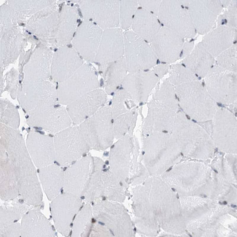 SFRS12 Antibody - BSA Free Immunohistochemistry-Paraffin: SFRS12 Antibody [NBP1-87993]