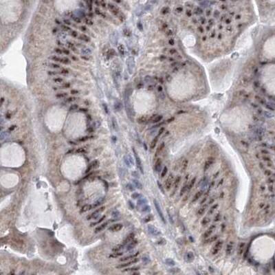 SFRS12 Antibody - BSA Free Immunohistochemistry-Paraffin: SFRS12 Antibody [NBP1-87993]