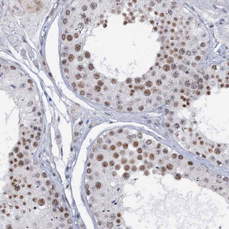 SFRS12 Antibody - BSA Free Immunohistochemistry-Paraffin: SFRS12 Antibody [NBP1-87993]