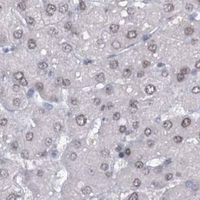 SFRS12 Antibody - BSA Free Immunohistochemistry-Paraffin: SFRS12 Antibody [NBP1-87993]