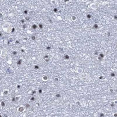 SFRS12 Antibody - BSA Free Immunohistochemistry-Paraffin: SFRS12 Antibody [NBP1-87993]