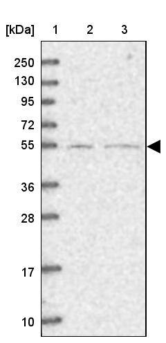 SFRS12 Antibody - BSA Free Western Blot: SFRS12 Antibody - BSA Free [NBP1-87993]