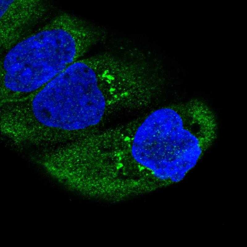 Ring finger protein 214 Antibody - BSA Free Immunocytochemistry/ Immunofluorescence: Ring finger protein 214 Antibody [NBP1-87994]