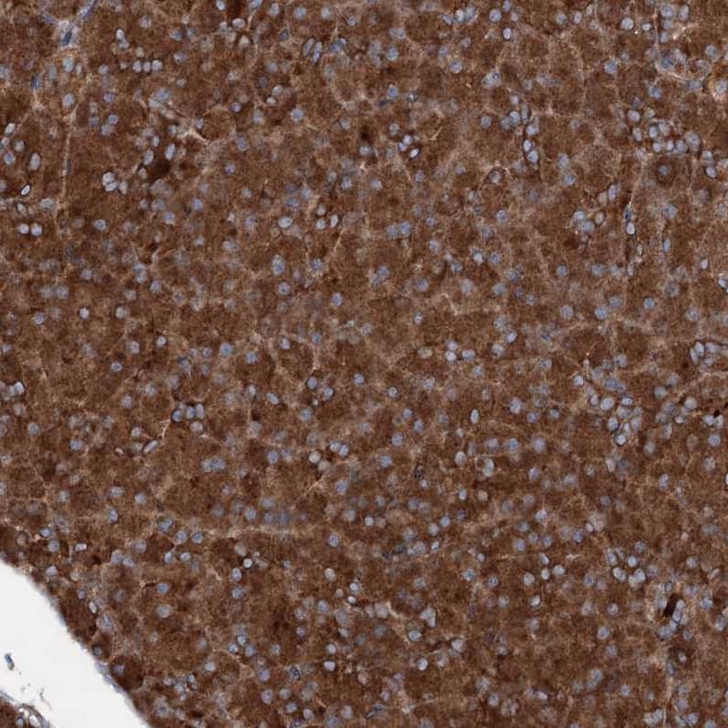 Ring finger protein 214 Antibody - BSA Free Immunohistochemistry-Paraffin: Ring finger protein 214 Antibody - BSA Free [NBP1-87994]