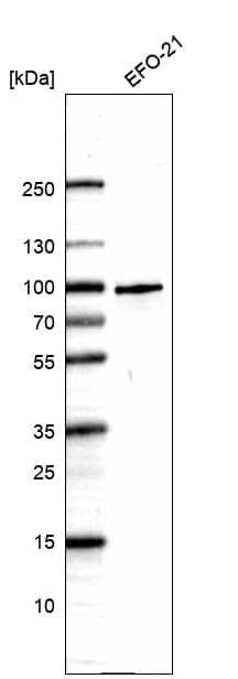 Ring finger protein 214 Antibody - BSA Free Western Blot: Ring finger protein 214 Antibody - BSA Free [NBP1-87994]