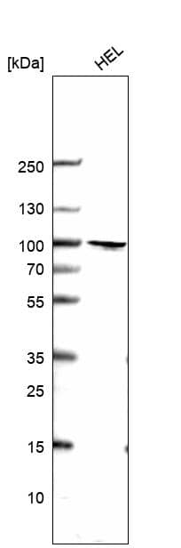 Ring finger protein 214 Antibody - BSA Free Western Blot: Ring finger protein 214 Antibody - BSA Free [NBP1-87994]