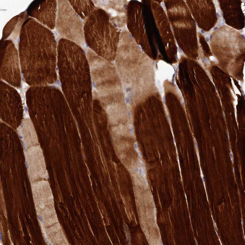 METTL20 Antibody - BSA Free Immunohistochemistry-Paraffin: METTL20 Antibody - BSA Free [NBP1-87995]