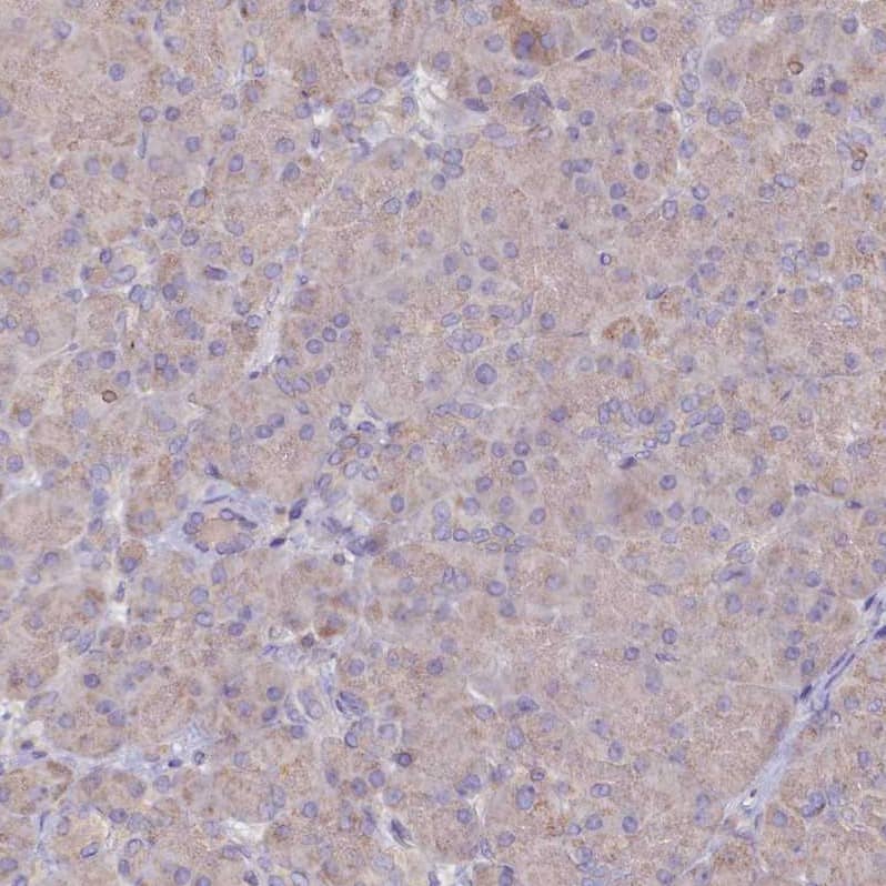 METTL20 Antibody - BSA Free Immunohistochemistry-Paraffin: METTL20 Antibody - BSA Free [NBP1-87995]