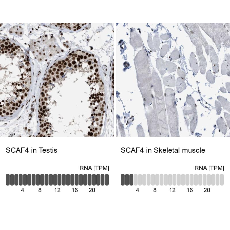 SFRS15 Antibody - BSA Free Immunohistochemistry-Paraffin: SFRS15 Antibody [NBP1-88002]