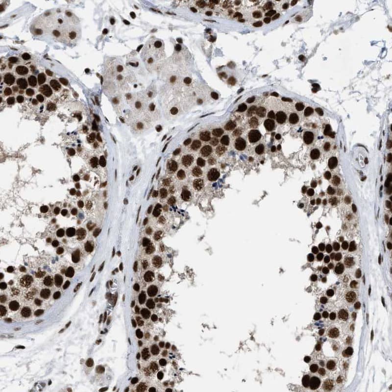 SFRS15 Antibody - BSA Free Immunohistochemistry-Paraffin: SFRS15 Antibody [NBP1-88002]