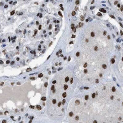 SFRS15 Antibody - BSA Free Immunohistochemistry-Paraffin: SFRS15 Antibody [NBP1-88002]