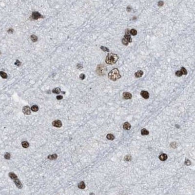 SFRS15 Antibody - BSA Free Immunohistochemistry-Paraffin: SFRS15 Antibody [NBP1-88002]