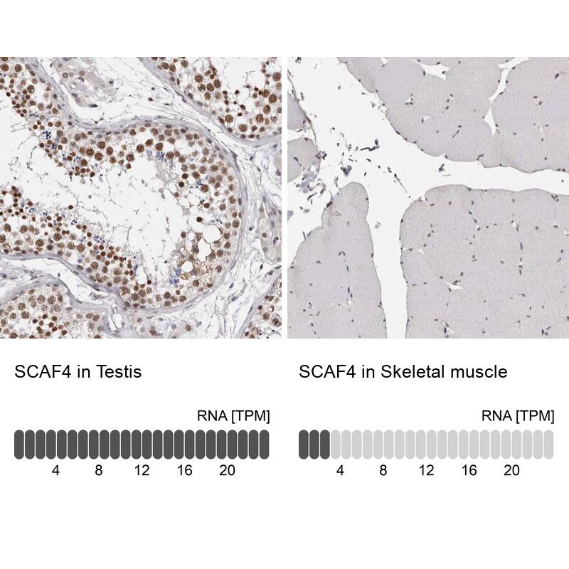 SFRS15 Antibody - BSA Free Immunohistochemistry-Paraffin: SFRS15 Antibody - BSA Free [NBP1-88003]