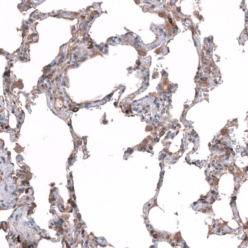 SGEF Antibody - BSA Free Immunohistochemistry-Paraffin: SGEF Antibody - BSA Free [NBP1-88006]