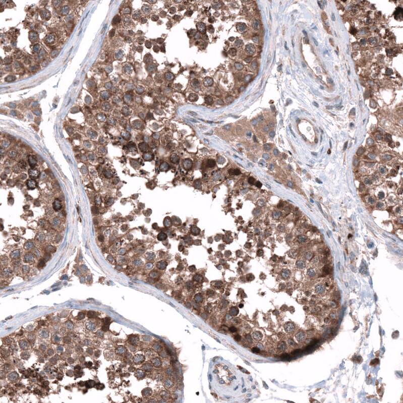 SGEF Antibody - BSA Free Immunohistochemistry-Paraffin: SGEF Antibody - BSA Free [NBP1-88006]