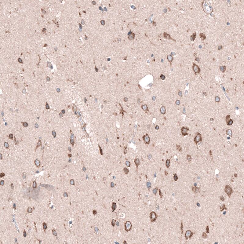 SGEF Antibody - BSA Free Immunohistochemistry-Paraffin: SGEF Antibody - BSA Free [NBP1-88006]
