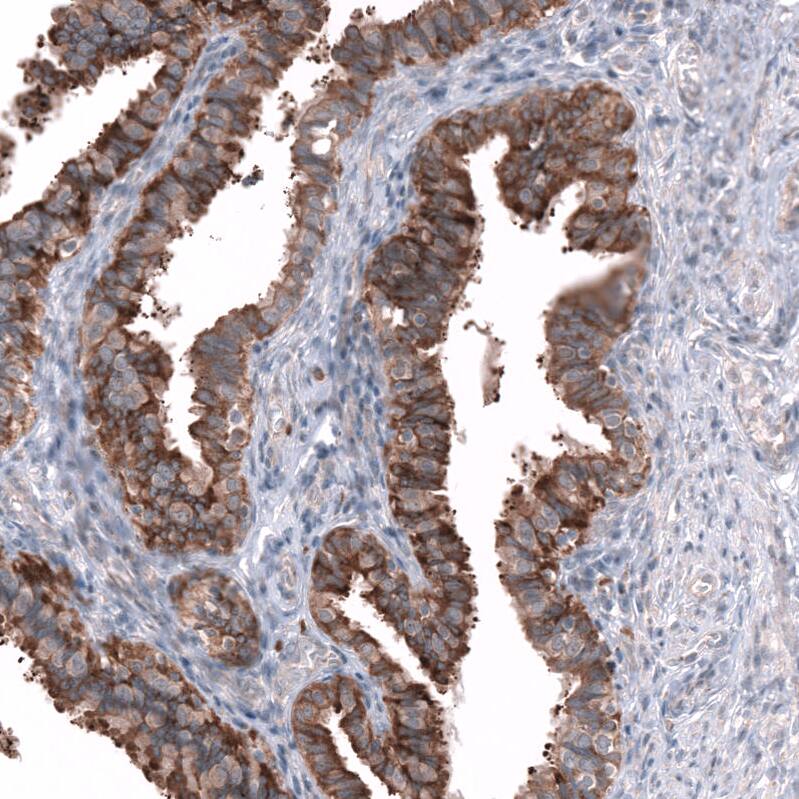 SGEF Antibody - BSA Free Immunohistochemistry-Paraffin: SGEF Antibody - BSA Free [NBP1-88006]