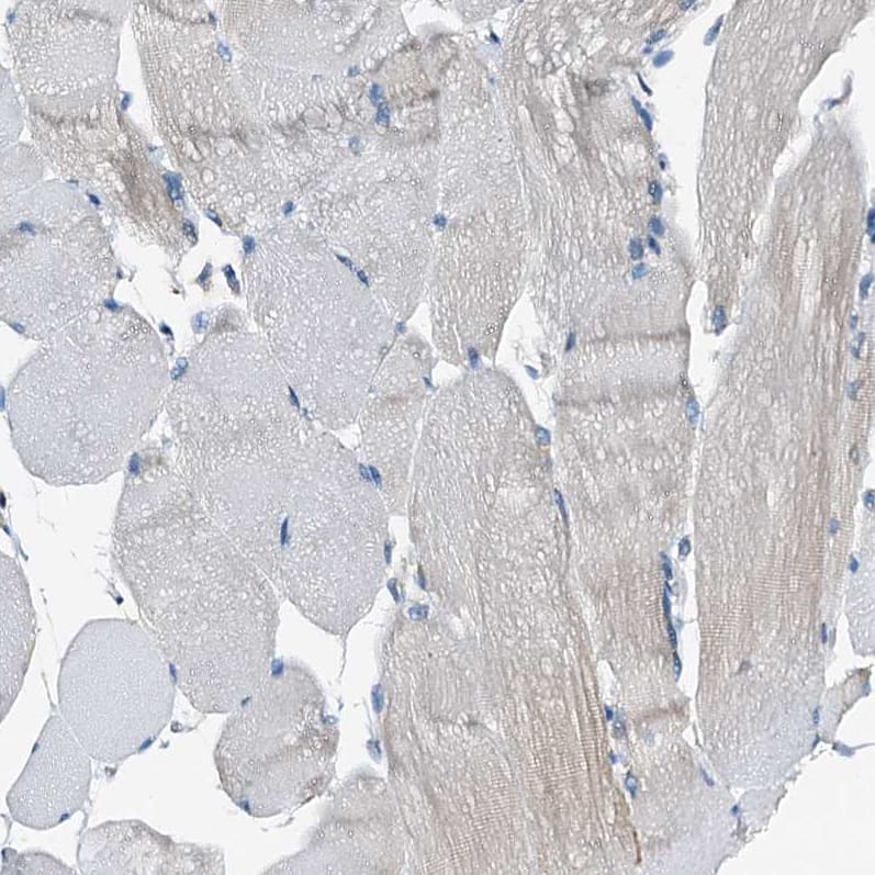 WDR51A Antibody - BSA Free Immunohistochemistry-Paraffin: WDR51A Antibody [NBP1-88008]