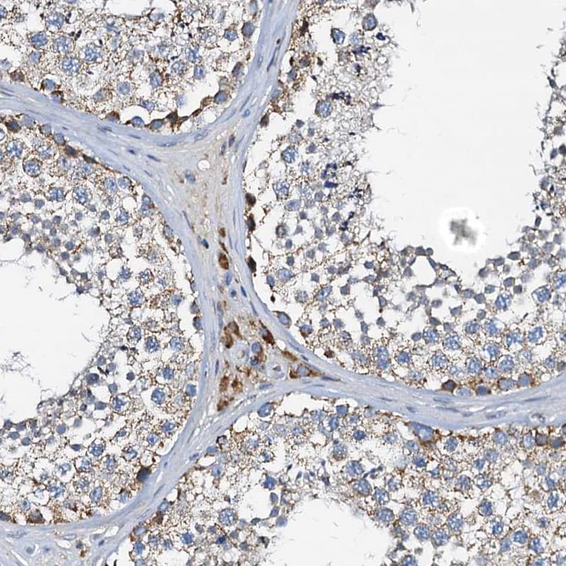WDR51A Antibody - BSA Free Immunohistochemistry-Paraffin: WDR51A Antibody [NBP1-88008]