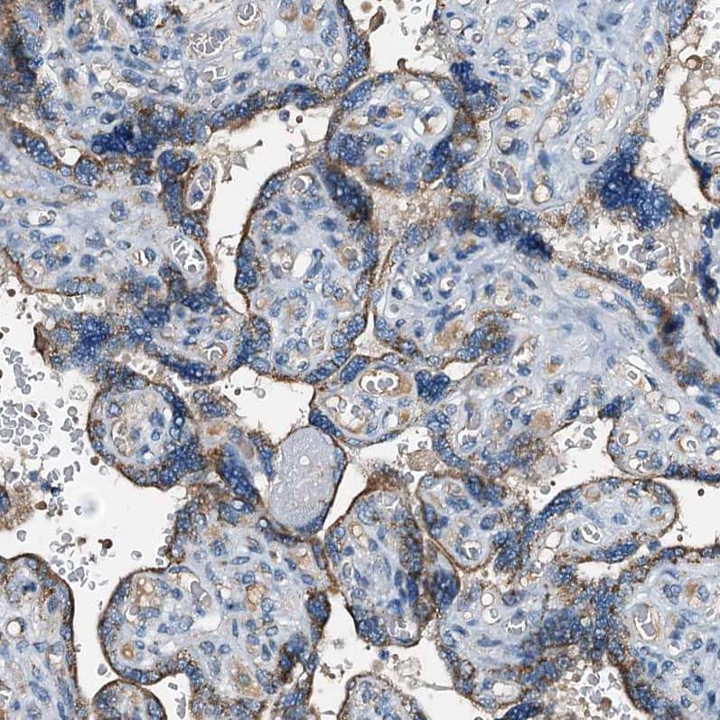 WDR51A Antibody - BSA Free Immunohistochemistry-Paraffin: WDR51A Antibody [NBP1-88008]