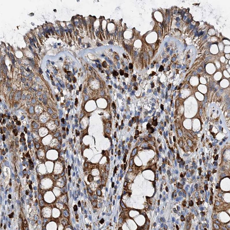 WDR51A Antibody - BSA Free Immunohistochemistry-Paraffin: WDR51A Antibody [NBP1-88008]