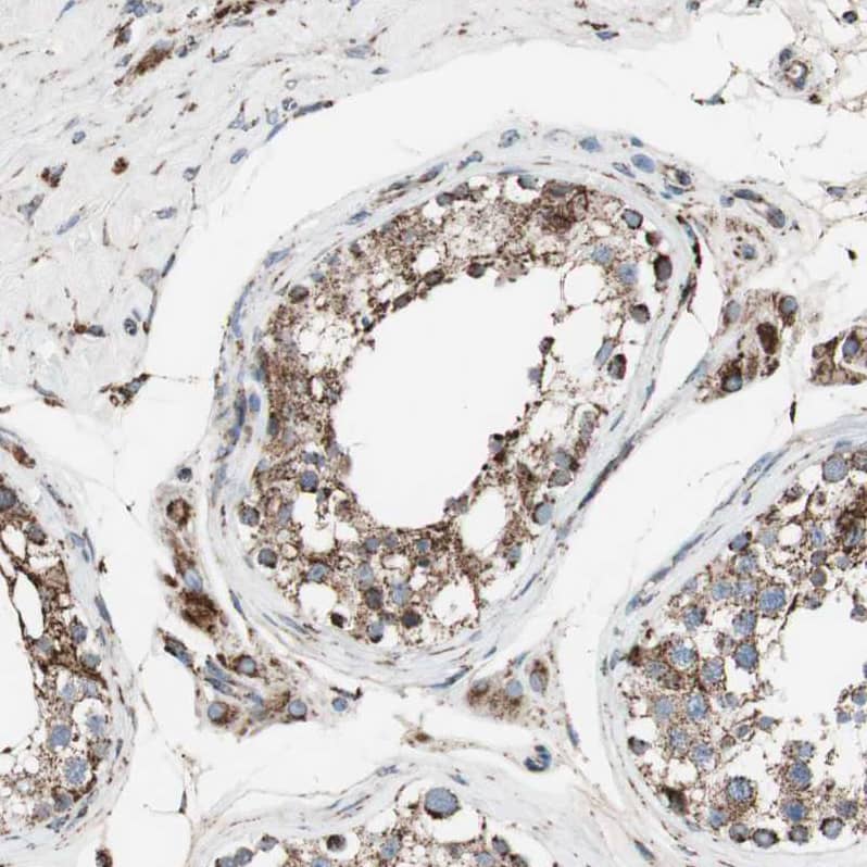Proprotein convertase PC4 Antibody - BSA Free Immunohistochemistry-Paraffin: Proprotein convertase PC4 Antibody - BSA Free [NBP1-88010]