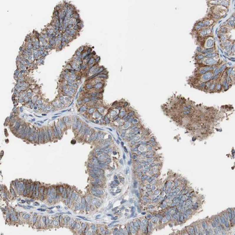 Proprotein convertase PC4 Antibody - BSA Free Immunohistochemistry-Paraffin: Proprotein convertase PC4 Antibody - BSA Free [NBP1-88010]