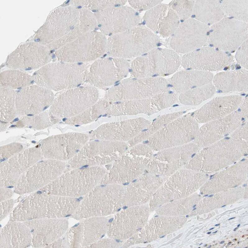 Proprotein convertase PC4 Antibody - BSA Free Immunohistochemistry-Paraffin: Proprotein convertase PC4 Antibody - BSA Free [NBP1-88010]