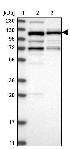 VPS50 Antibody - BSA Free Western Blot: VPS50 Antibody - BSA Free [NBP1-88012]
