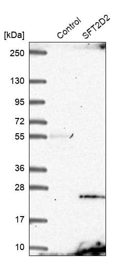 SFT2B Antibody - BSA Free Western Blot: SFT2B Antibody - BSA Free [NBP1-88013]