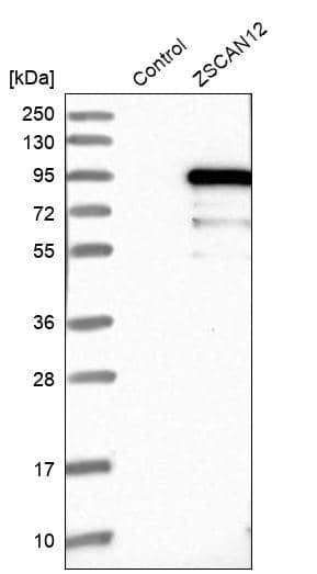 ZNF96 Antibody - BSA Free Western Blot: ZNF96 Antibody - BSA Free [NBP1-88018]