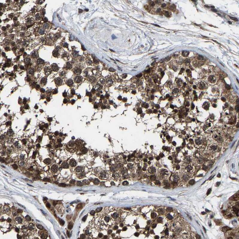 FAM29A Antibody - BSA Free Immunohistochemistry-Paraffin: FAM29A Antibody - BSA Free [NBP1-88022]