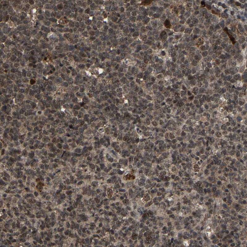 FAM29A Antibody - BSA Free Immunohistochemistry-Paraffin: FAM29A Antibody - BSA Free [NBP1-88022]