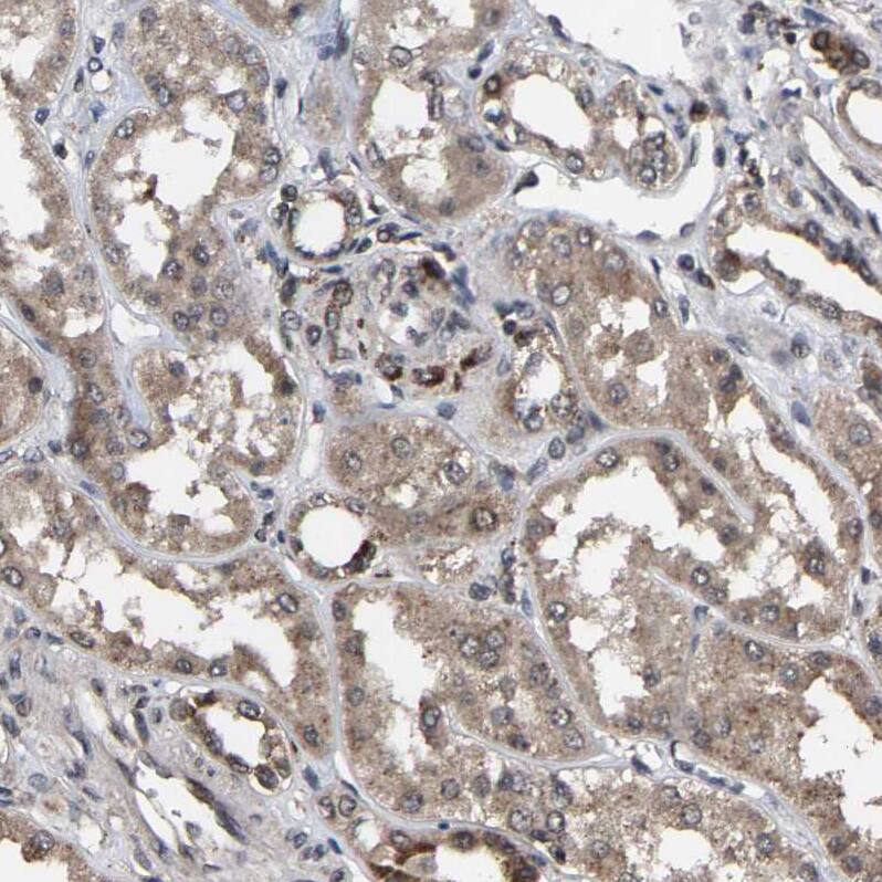 FAM29A Antibody - BSA Free Immunohistochemistry-Paraffin: FAM29A Antibody - BSA Free [NBP1-88022]
