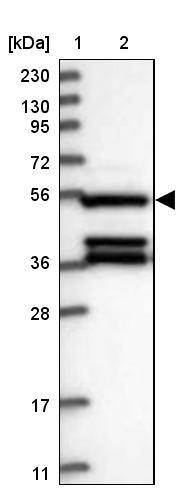DELGEF Antibody - BSA Free Western Blot: DELGEF Antibody - BSA Free [NBP1-88025]