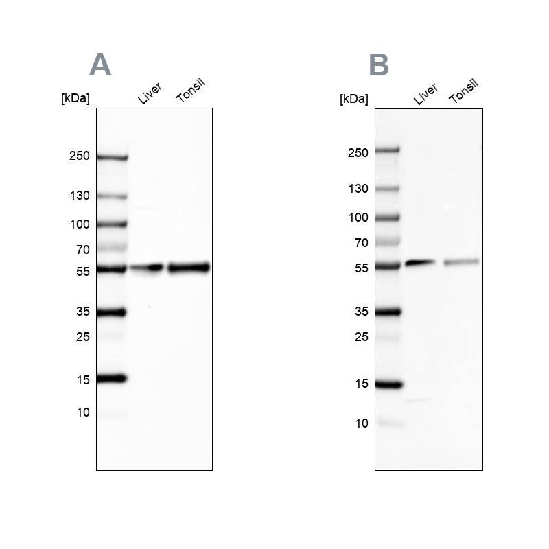 Vitamin D BP Antibody - BSA Free Western Blot: Vitamin D BP Antibody - BSA Free [NBP1-88027]